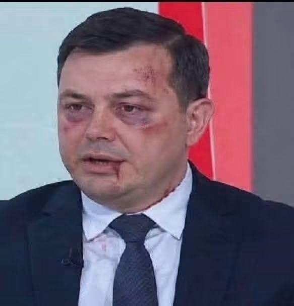  Վրաստանի խորհրդարանում ընդդիմադիր պատգամավորին ծեծի ենթարկելուց հետո քրեական գործ չի հարուցվել․ ԶԼՄ